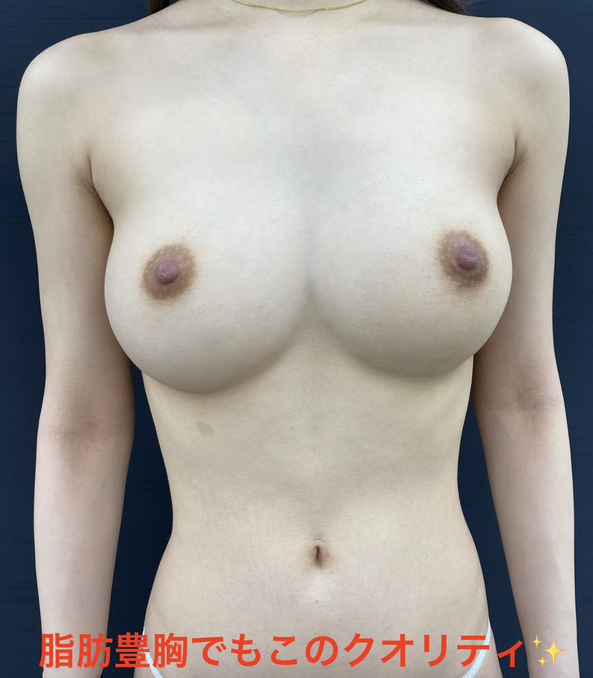 下乳が伸びるとバランスが改善