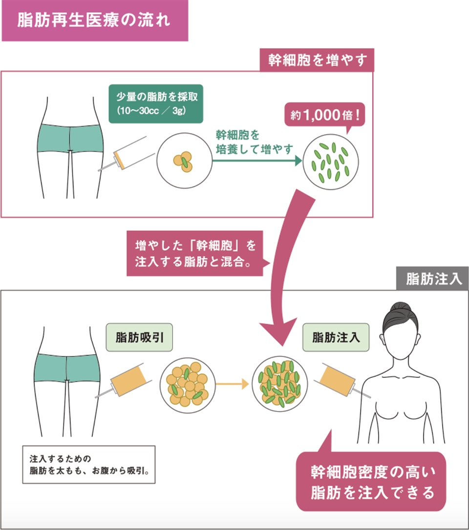 母乳 しこり ほぐし 方