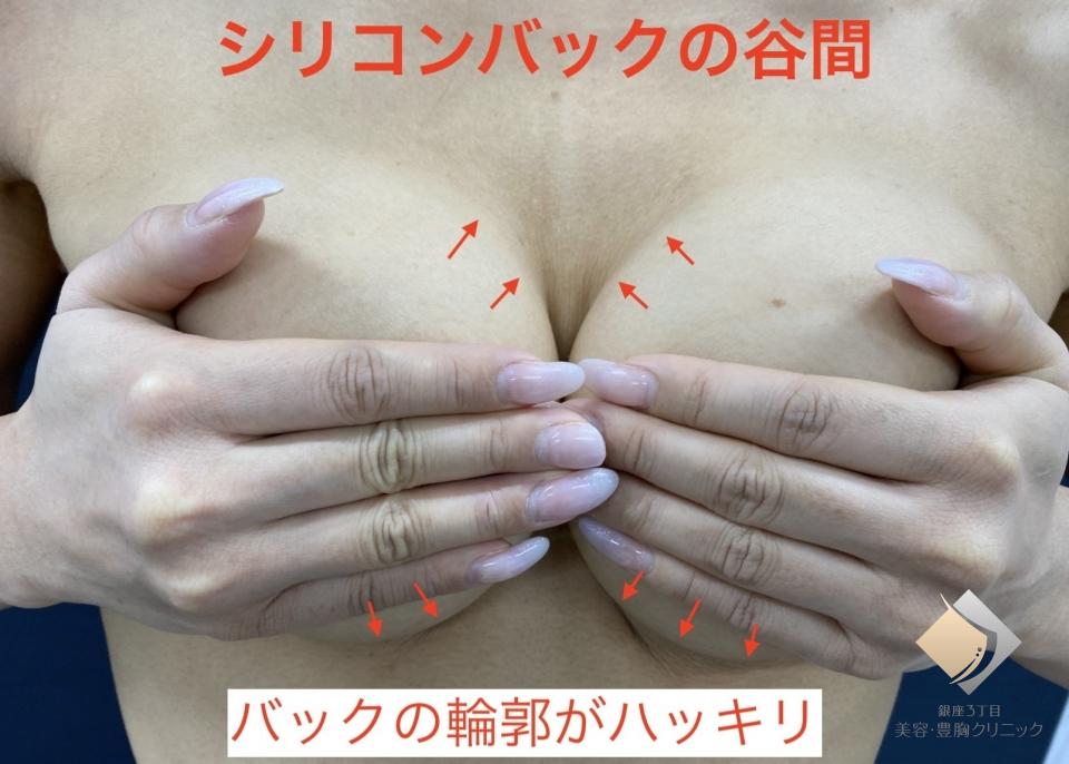 症例画像2