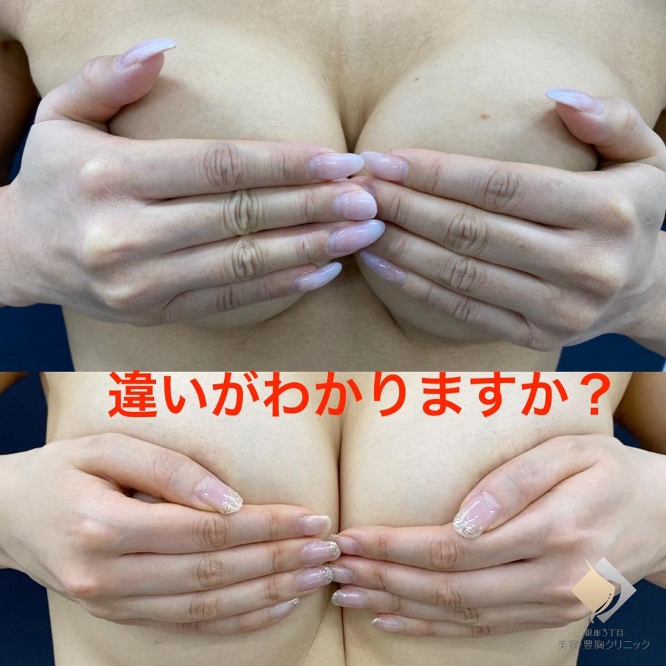 症例画像8