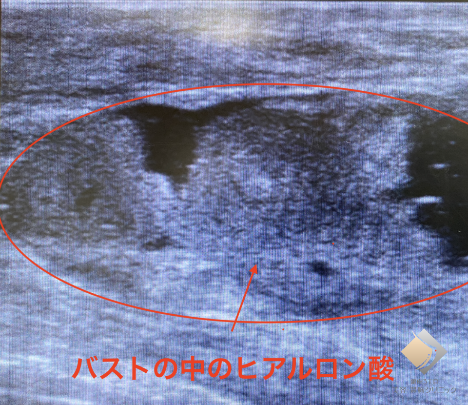 症例画像4