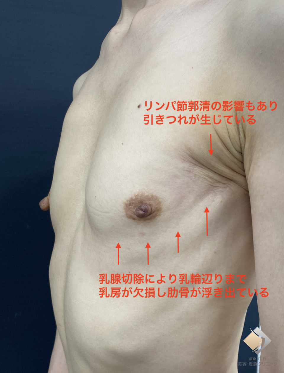 症例画像2