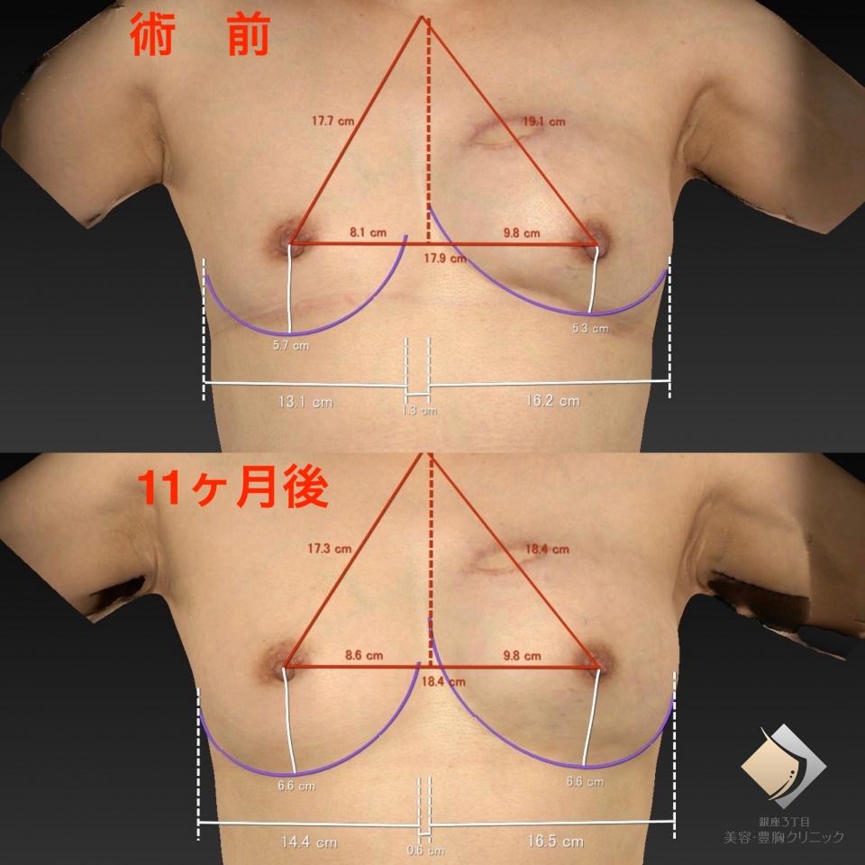 症例画像6