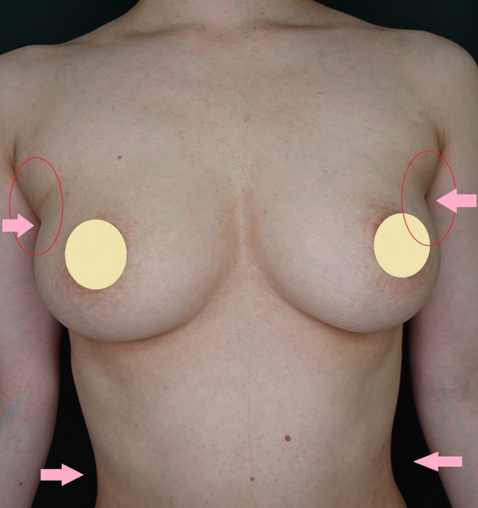 女性らしいボディーには、２つのくびれがある！（←外乳の重要性の証！）