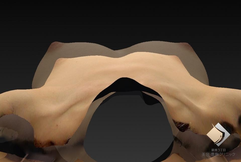 症例画像4
