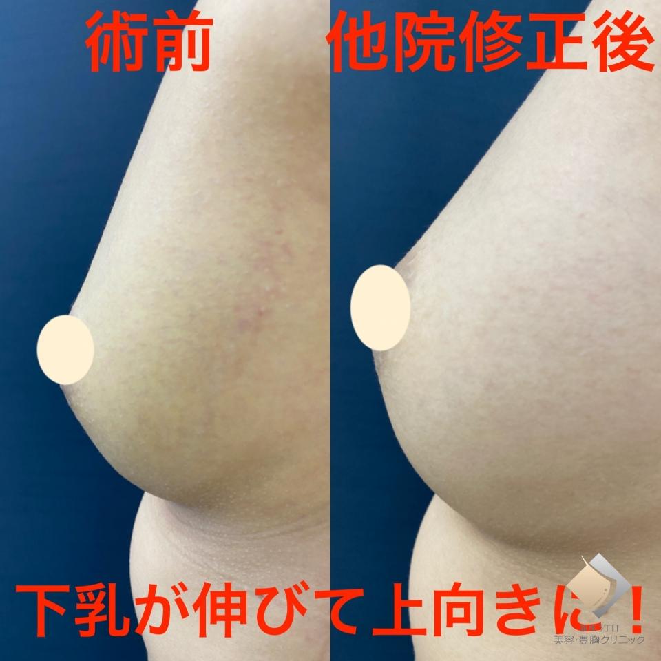 症例画像4