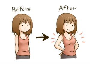 脂肪豊胸で二の腕から脂肪採取|腕痩せ効果は期待できる?