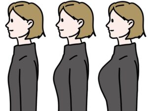 脂肪豊胸の分割払い・ローン｜月々いくらで受けられる？