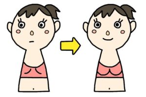 Aカップから脂肪豊胸でCカップに|2カップアップの実際