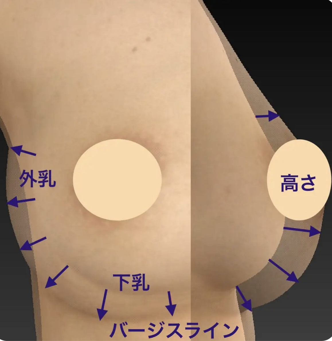 外乳・下乳・高さ・バージスラインの4つの形態要素を示した3D重ね合わせ図